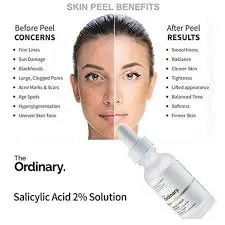 THE ORDINARY SALICYLIC ACID 2% SOLUTION 30ML