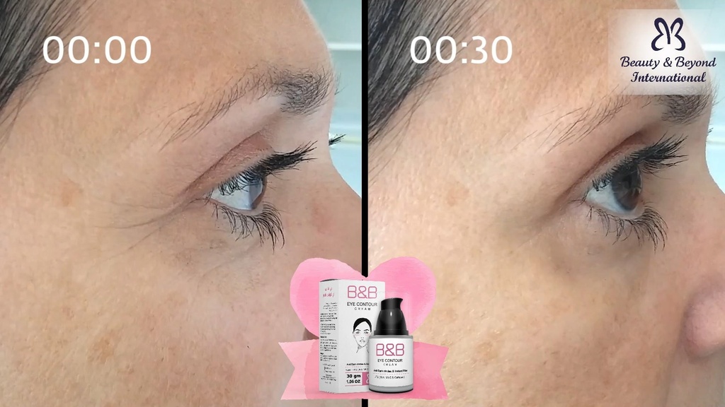 B & B EYE CONTOUR  CREAM 30GM
