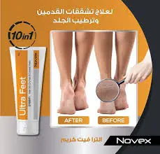 ULTRA FEET CREAM 50 MG