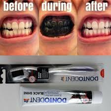 [38006] DENTO DENT BLACK SHINE 75ML